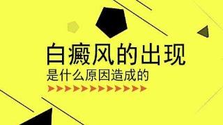 昆明治疗白癜风医生介绍白癜风的发病原因有什么